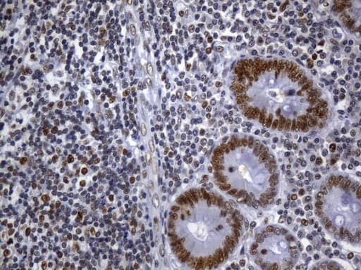Monoclonal Mouse anti-Human MSH2 Antibody (clone UMAB259, Carrier-free, aa1-304, IHC)