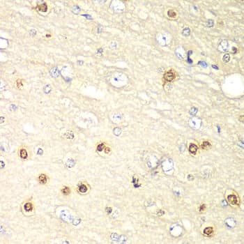 Polyclonal Rabbit anti-Human HIF1AN Antibody (IHC, IF, WB)
