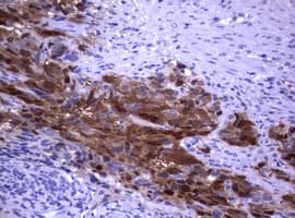 TS / Thymidylate Synthase Antibody (clone OTI1A6)