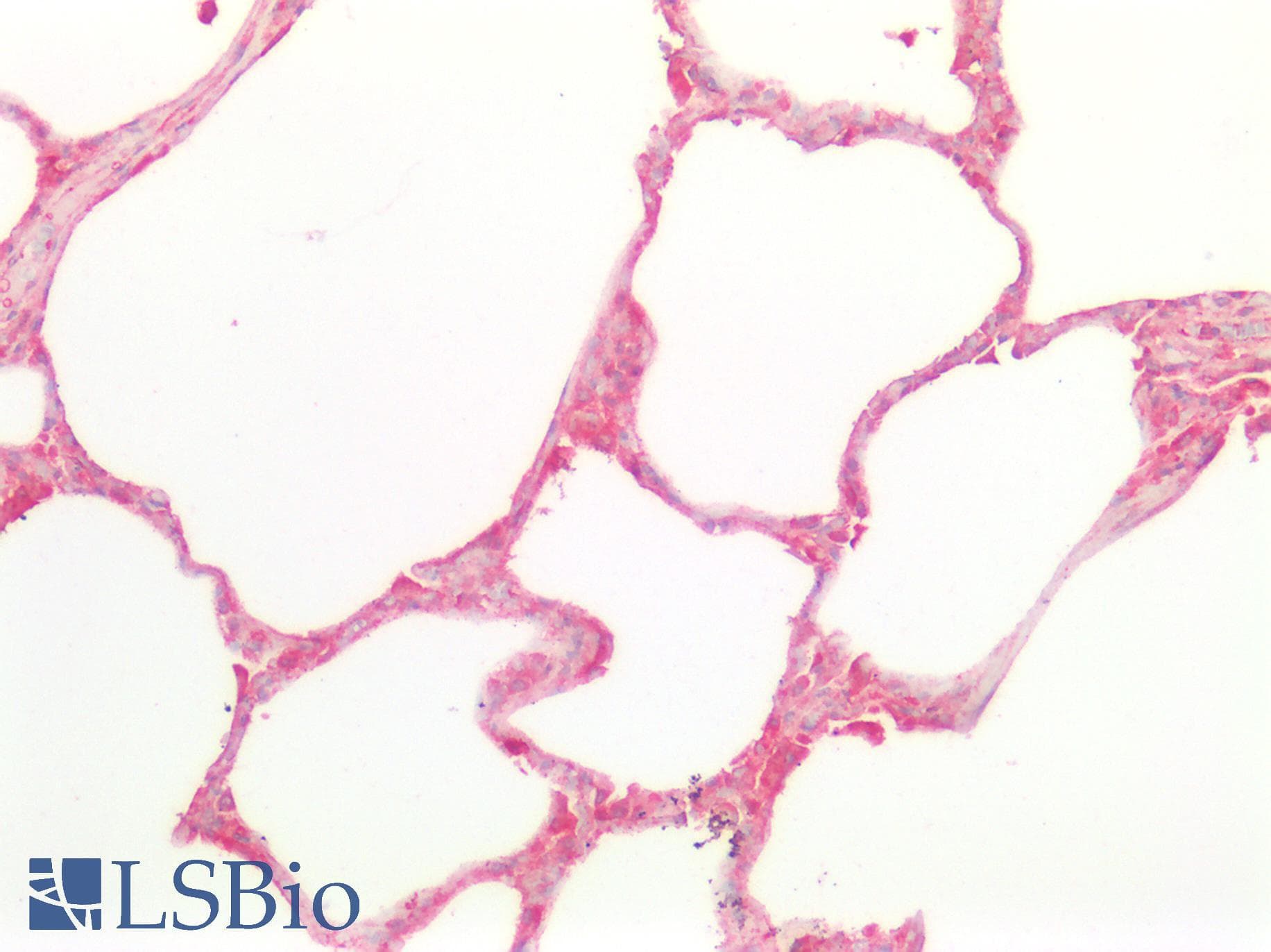 IHC-plus™ Polyclonal Rabbit anti-Human CTSD / Cathepsin D Antibody (IHC, IF, WB)