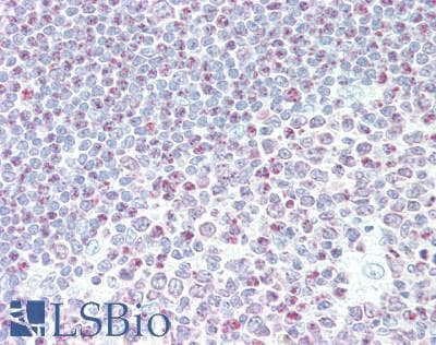 IHC-plus™ Polyclonal Rabbit anti-Human IKZF2 / HELIOS Antibody (aa325-375, IHC)