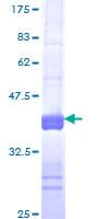 Human FMR1 / FMRP Protein (Recombinant GST, N-terminus)