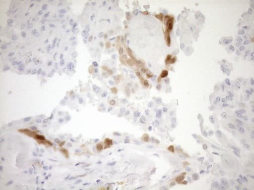 p16INK4a / CDKN2A Antibody (clone OTI7B10)