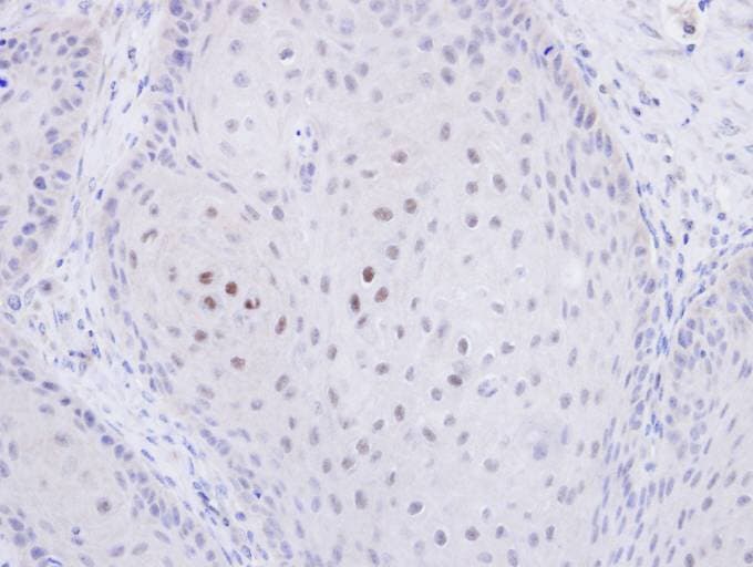 C20orf11 / TWA1 Antibody (aa1-208)