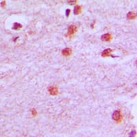 HOXA11+HOXD11 Antibody (C-Terminus)