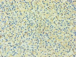 HLA-G Antibody (aa20-230)