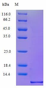 Human I-309 / CCL1 Protein (Recombinant)