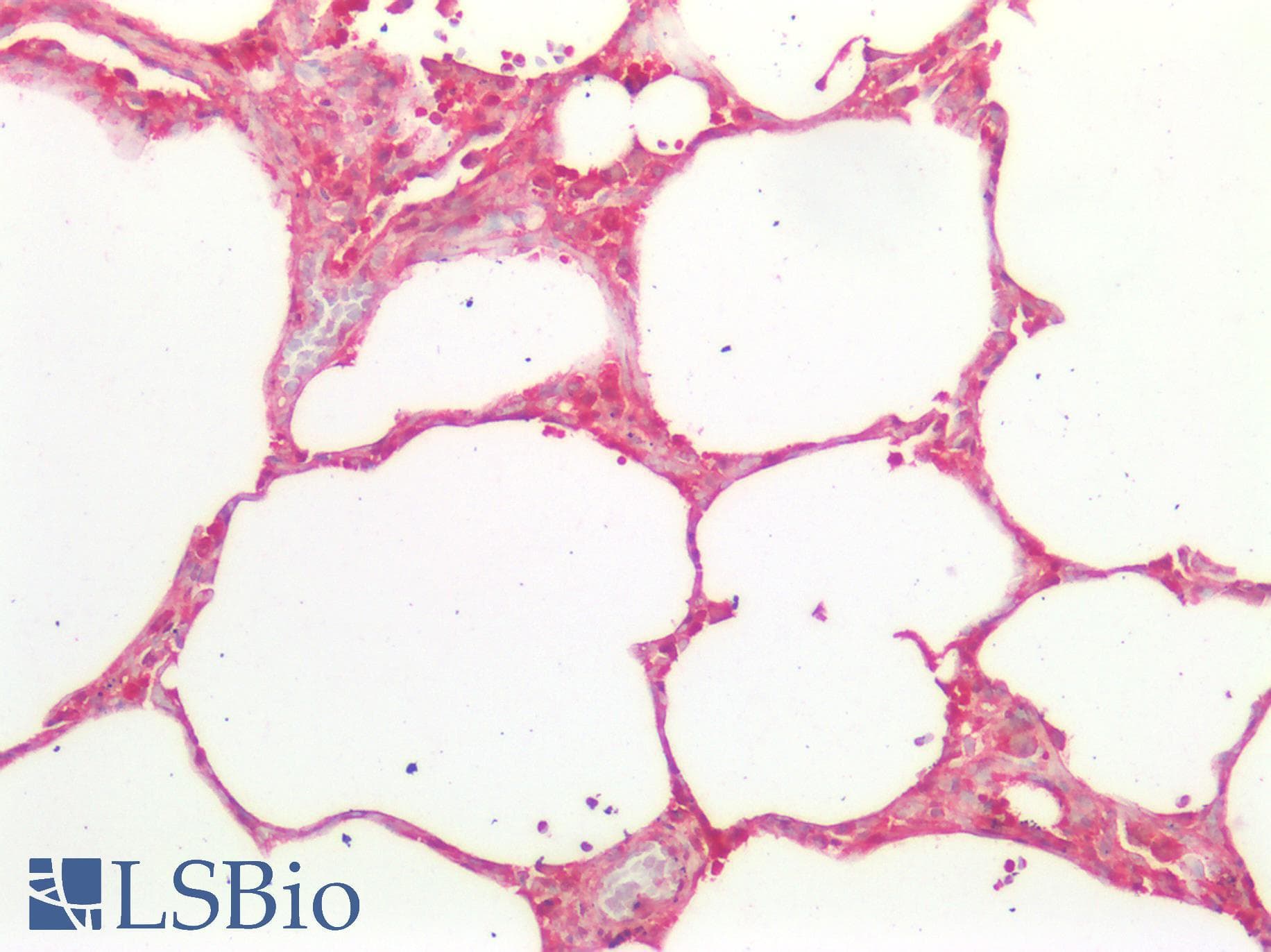 IHC-plus™ Polyclonal Rabbit anti-Human ICAM-1 / CD54 Antibody (IHC)