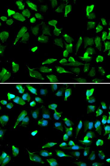SATB1 Antibody