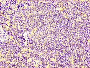Polyclonal Rabbit anti-Human CNOT3 Antibody (IHC)
