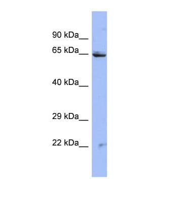 Polyclonal Rabbit anti-Human ZNF284 Antibody (N-Terminus, WB)