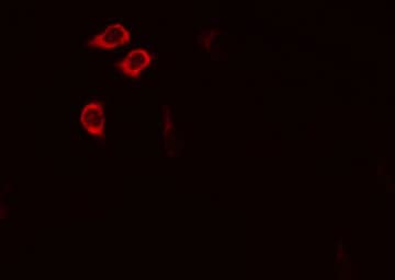 IARS2 Antibody