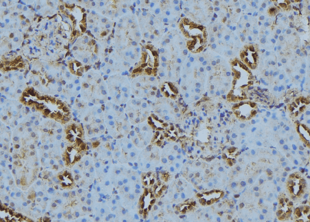PLOD3 Antibody