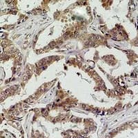CASP8 / Caspase 8 Antibody