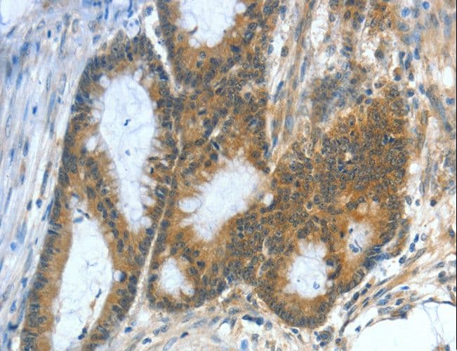 ASNS Antibody