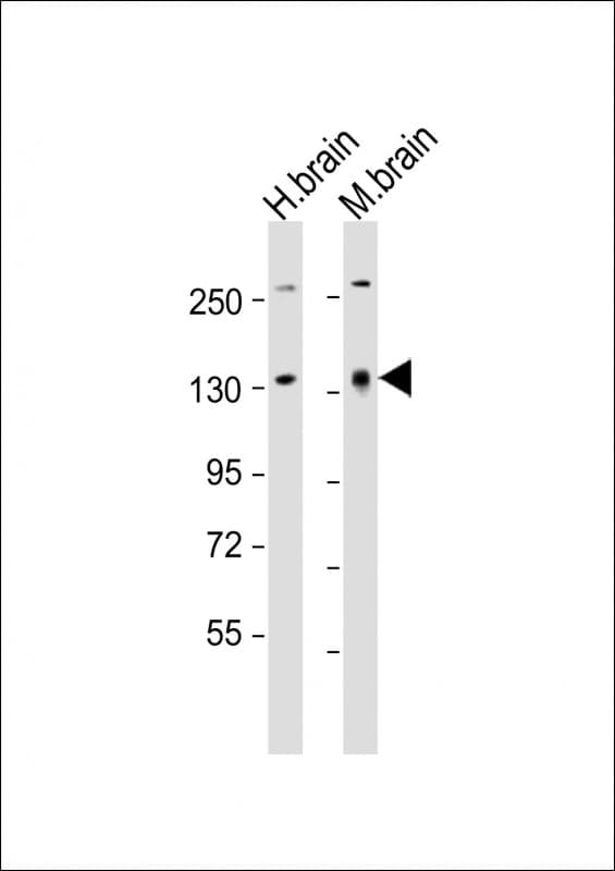 ATXN2 / SCA2 / Ataxin-2 Antibody (aa321-355)