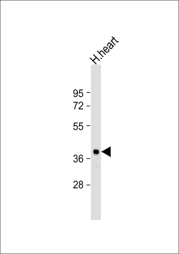 PPM1K Antibody