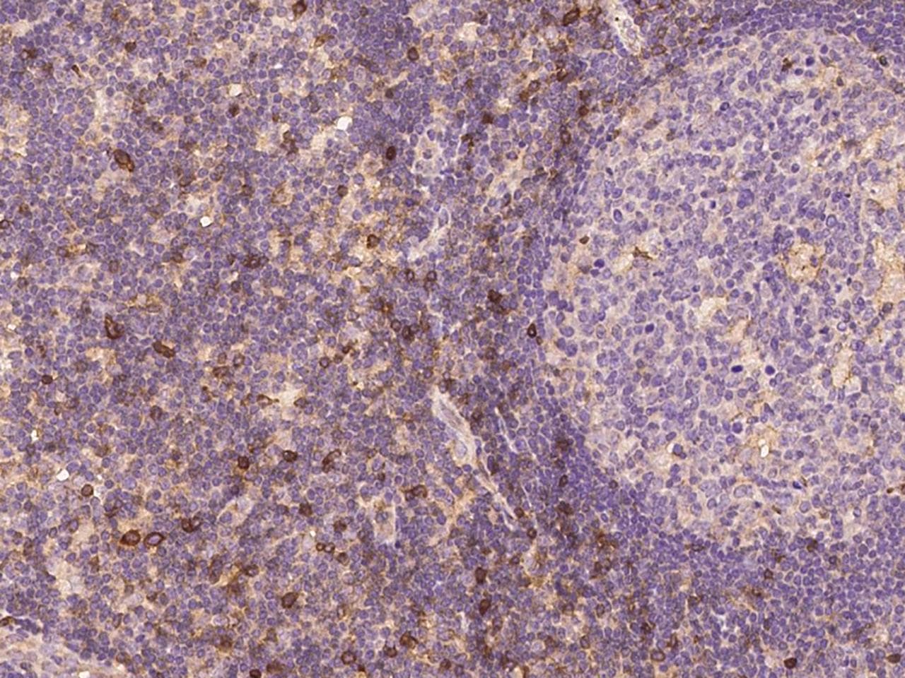 Polyclonal Rabbit anti-Human IL2RA / CD25 Antibody (Preservative Free, IHC)