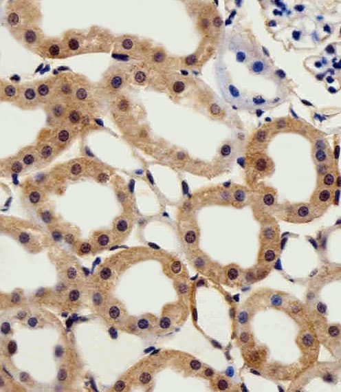 CSNK2A1 Antibody (aa250-284)