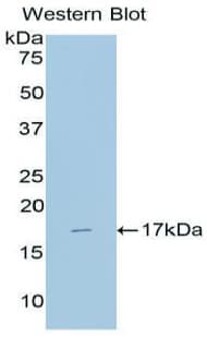 Alpha-Fetoprotein Antibody (aa31-171)