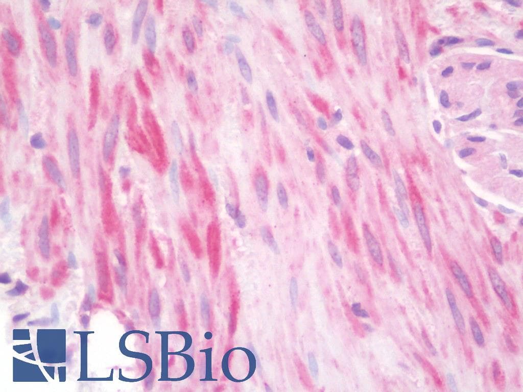 IHC-plus™ SHFM3 / FBXW4 Antibody (aa5-186)