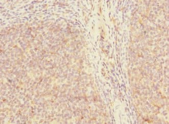 Polyclonal Rabbit anti-Human SH3D19 Antibody