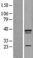 LDB2 Protein (Over-Expression Lysate Myc-DDK (Flag))