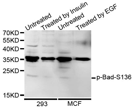 Polyclonal Rabbit anti-Human BAD Antibody (phospho-Ser99, IHC, WB)