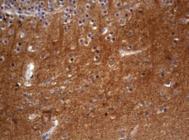 VILIP / VSNL1 Antibody (aa2-191, clone OTI1G10, Carrier-free)