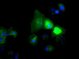 Monoclonal Mouse anti-Human NPR3 Antibody (clone OTI11H6, IHC, IF, WB)