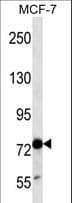 Polyclonal Rabbit anti-Human GRG4 / TLE4 Antibody (aa167-196, WB)