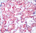 GATA1 Antibody