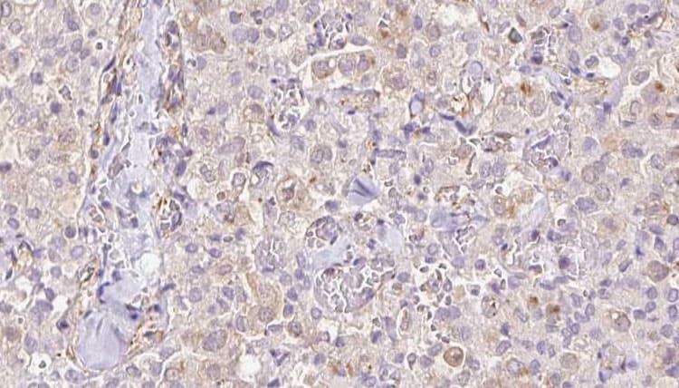 Polyclonal Rabbit anti-Human TIMM9 Antibody (IHC, IF, WB)