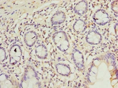 Polyclonal Rabbit anti-Human C9orf16 Antibody (IHC)