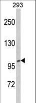 Polyclonal Rabbit anti-Human CTDP1 / FCP1 Antibody (aa247-276, IHC, WB)
