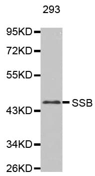 SSB / La Antibody