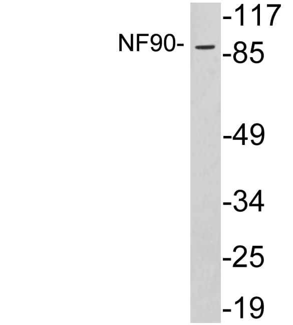 IHC-plus™ NF90 / ILF3 Antibody (aa302-351)