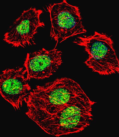 IHC-plus™ TP53 / p53 Antibody (Ser315)