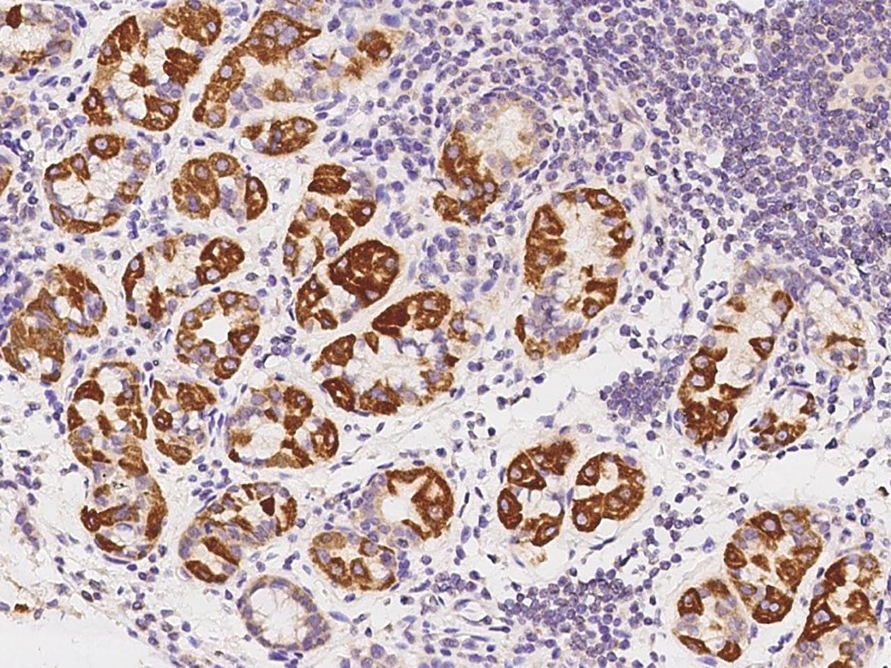 MPZL2 Antibody