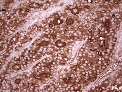 TG / Thyroglobulin Antibody (aa20-358, clone OTI15E11)