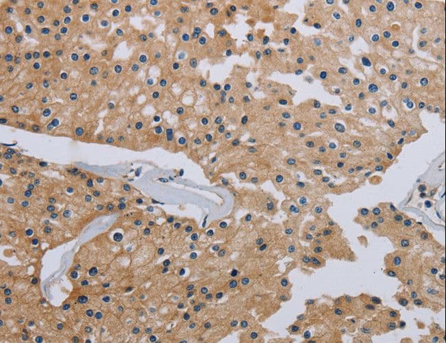 HSD3B7 Antibody