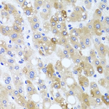 MNK / ATP7A Antibody