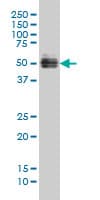 Monoclonal Mouse anti-Human GATA2 Antibody (clone 2D11, IF, WB)