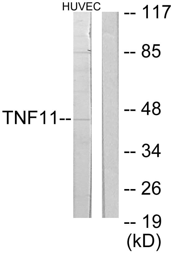 TNFSF11 / RANKL / TRANCE Antibody (aa41-90)