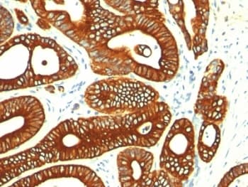 KRT18 / CK18 / Cytokeratin 18 Antibody (clone KRT18/835)