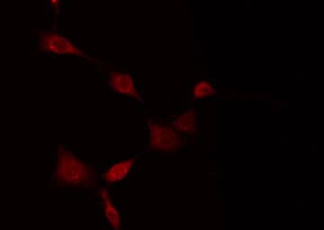 Polyclonal Rabbit anti-Human MT-ND5 Antibody (IF, WB)