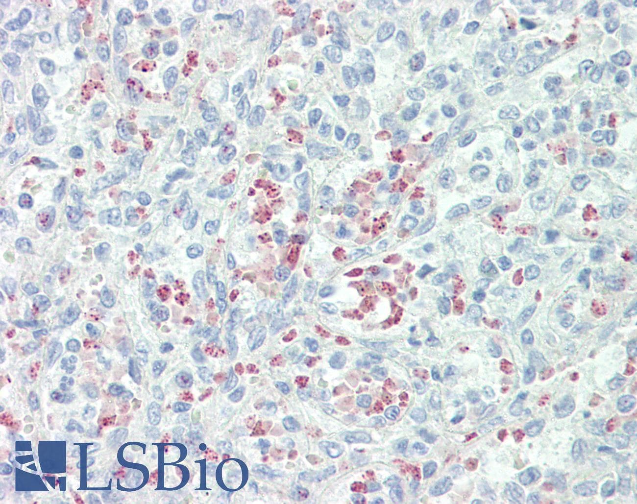 IHC-plus™ Polyclonal Rabbit anti-Human Mannose Receptor / CD206 Antibody (aa359-388, IHC, WB)