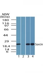 IHC-plus™ SRI / Sorcin Antibody (aa50-100)