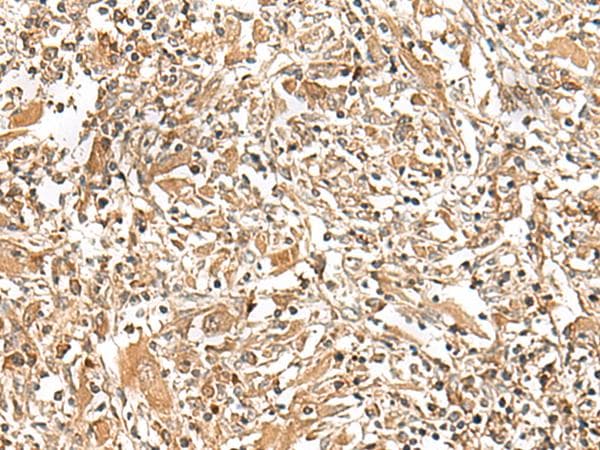 GEMIN4 Antibody