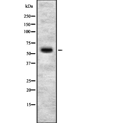 ADCK4 Antibody